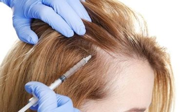 Yıpranan saçlar için tedavi yöntemleri