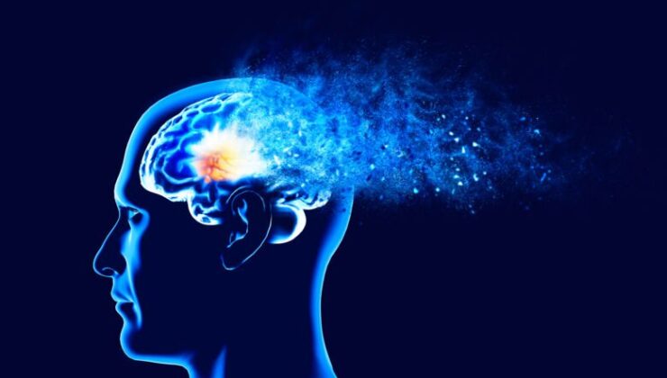 Alzheimer Hastalığını 20 Yıl Önceden Belirten İşaret: Viseral Yağlanma